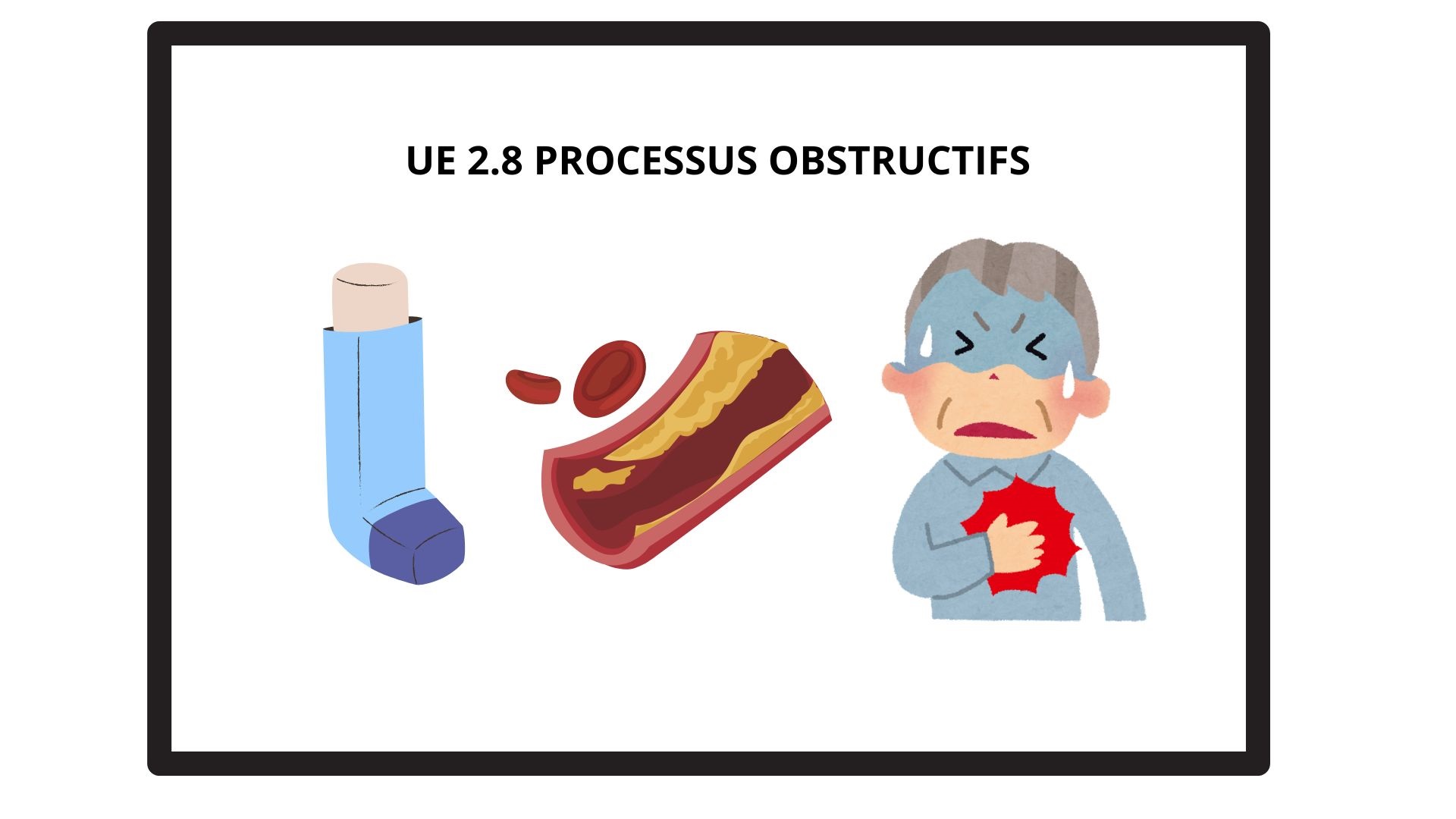 Processus obstructifs